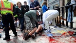 The bombs that made Boston look like a combat zone have also brought battlefield medicine to their civilian victims. A decade of wars in Iraq and Afghanistan has sharpened skills and scalpels, leading to dramatic advances that are now being used to treat the  amputees and nearly a dozen other patients still fighting to keep damaged limbs after Monday's attack